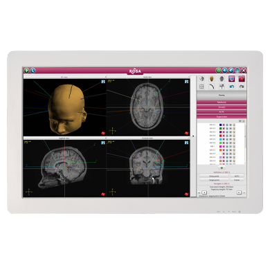ROSA One Brain from Zimmer Biomet