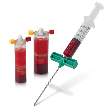 BioCUE® Bone Marrow Aspiration (BBMA) Concentration System from Zimmer Biomet