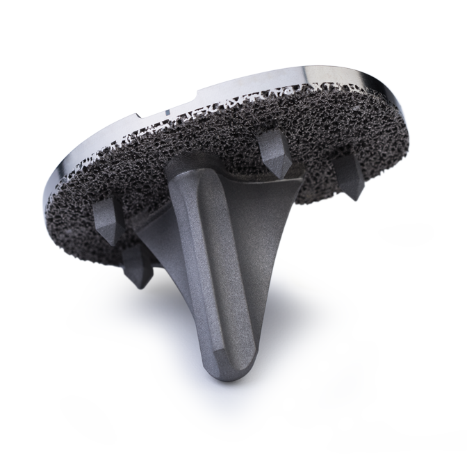 Zimmer Biomet Persona® OsseoTi®Keel Tibia Zimmer Biomet Persona® OsseoTi®Keel Tibia